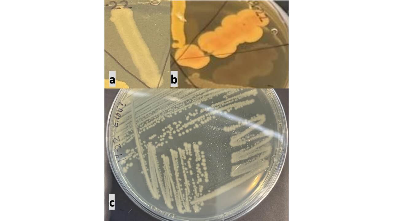 Photo of figure 2: (a) Original growth taken February 3. (b) Additional growth and morphology changes were observed over time during refrigerated storage (March 19). (c) Sample 22 streaked for isolation.