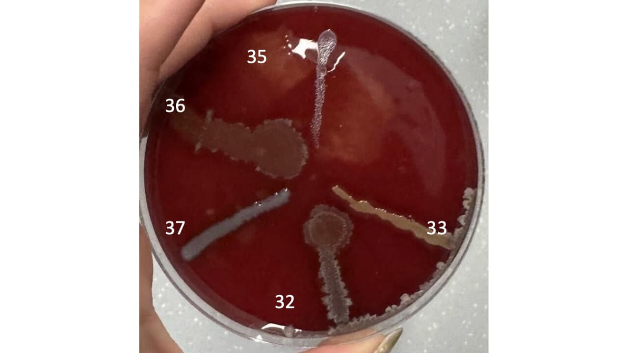 Figure 3: growth on BAP, Microorganisms replated growth on BAP. Identified organisms include Bacillus subtilis (32, 36), Staphylococcus aureus (33), Staphylococcus epidermidis (35), Photobacterium (37)
