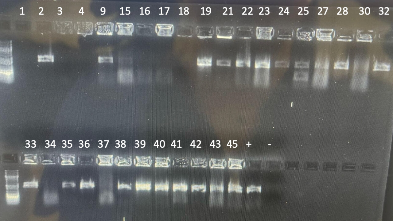 Photo of figure 7: PCR amplification on gel electrophoresis. DNA samples were amplified using PCR targeting the bacterial 16S rRNA gene. 31 samples were amplified and 27 displayed a visual band on agarose gel (87.1%). 4/31 (12.9%) showed no amplification. Positive and negative controls were included